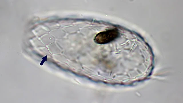 Euglypha crenulata