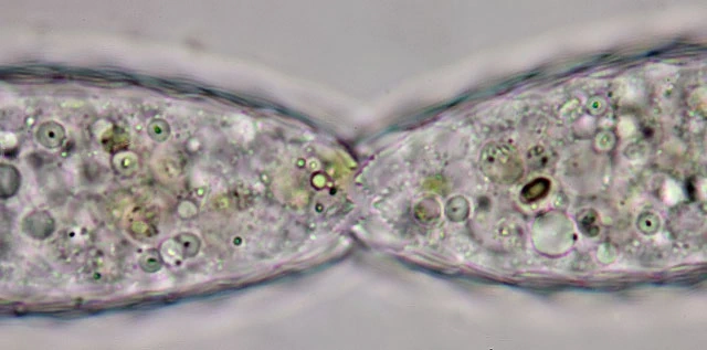 Division of Euglypha acantophora