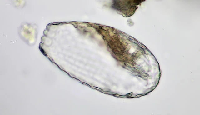 Euglypha tuberculata