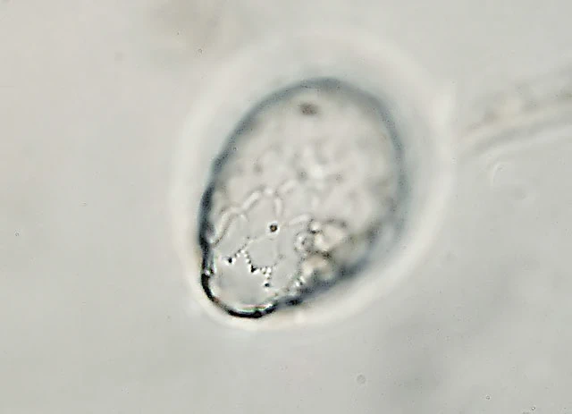 Euglypha tuberculata