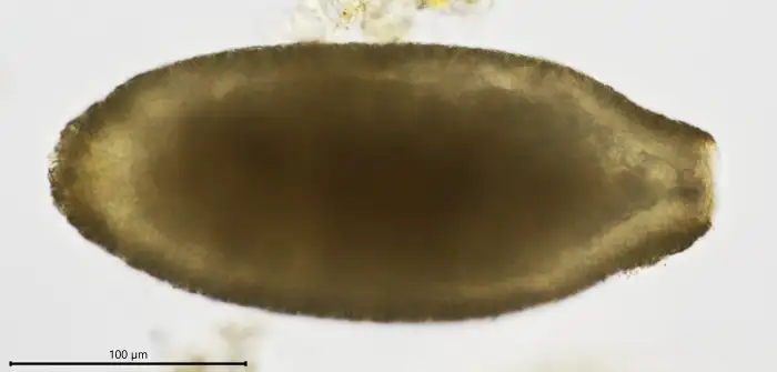 Unknown freshwater foraminifer