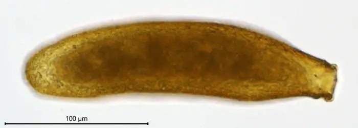 Unknown freshwater foraminifer