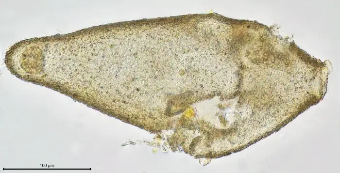 Unknown freshwater foraminifer