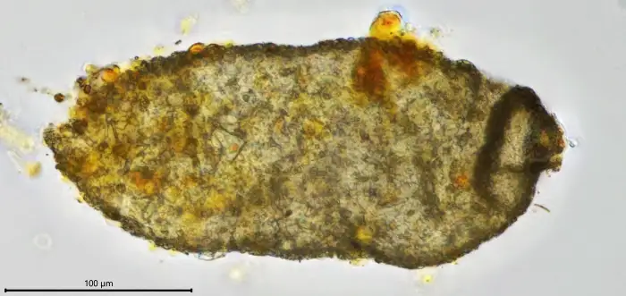 Unknown freshwater foraminifer