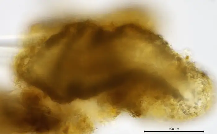 Unknown freshwater foraminifer