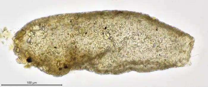 Unknown freshwater foraminifer