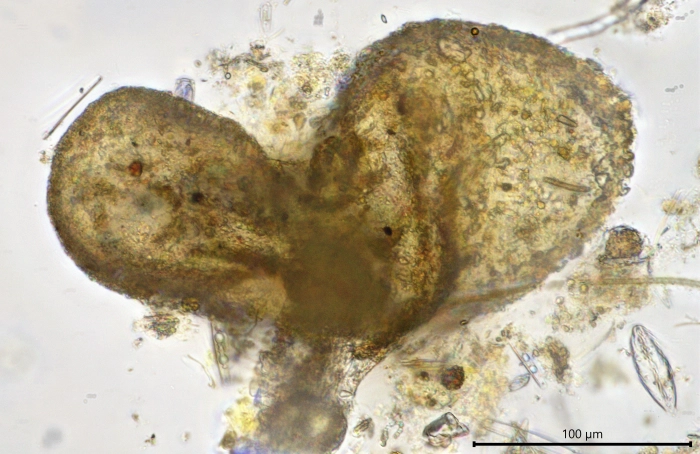 Unknown freshwater foraminifer