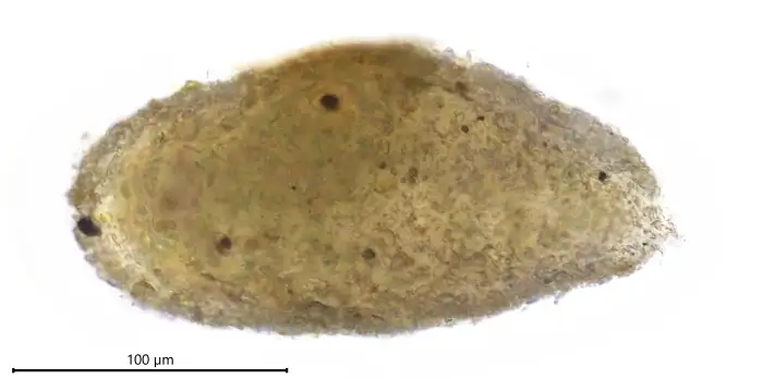 Unknown freshwater foraminifer