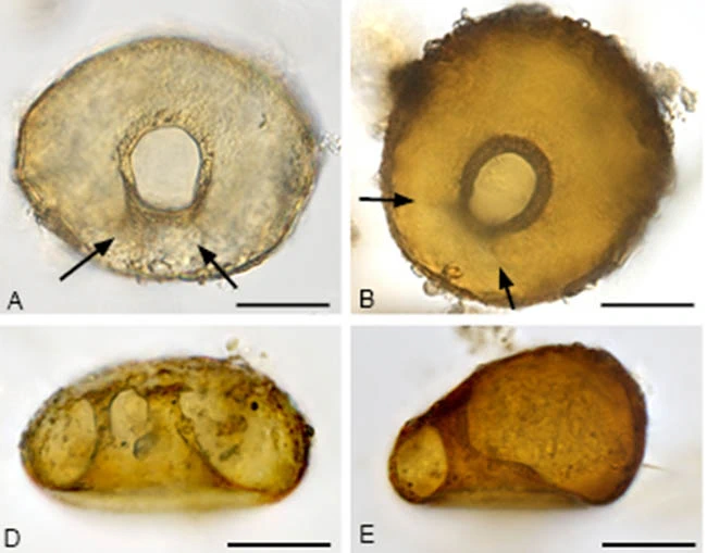 Centropyxis bipilata