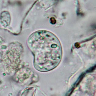 Frenzelina reniformis