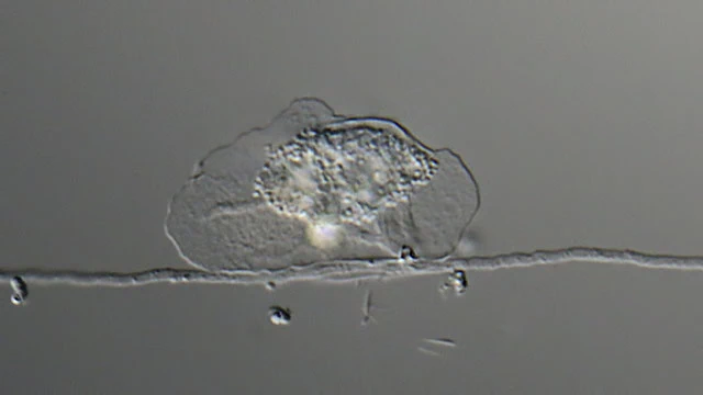 Fungus preying on amoebae