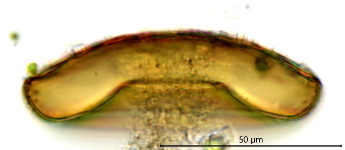 Galeripora scutelliformis