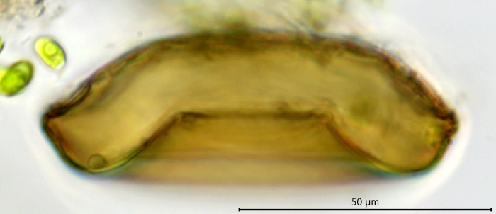 Galeripora scutelliformis