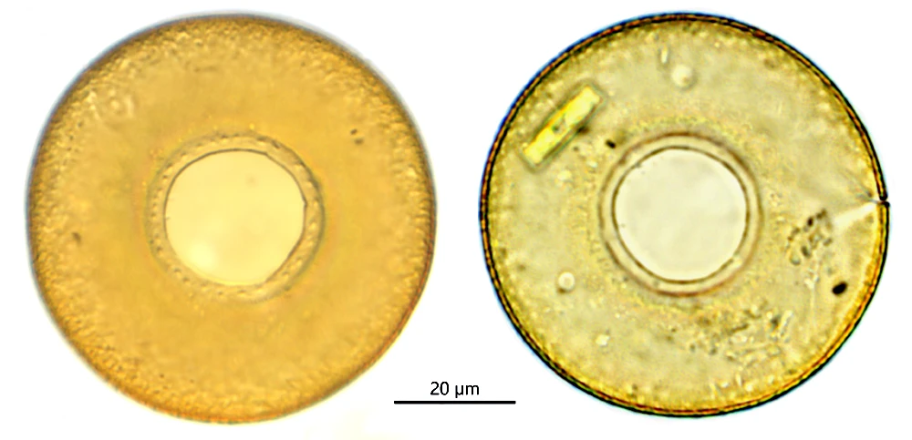 Galeriporascutelliformis