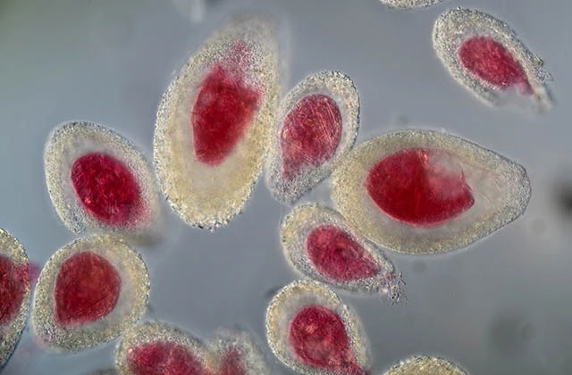 Lacogromia brunneri