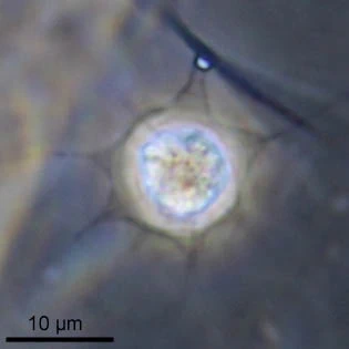 Hedriocystis brachypous