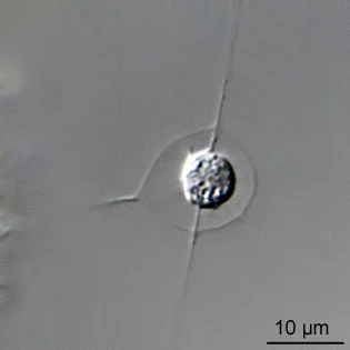 Hedriocystis minor