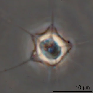 Hedriocystis pellucida