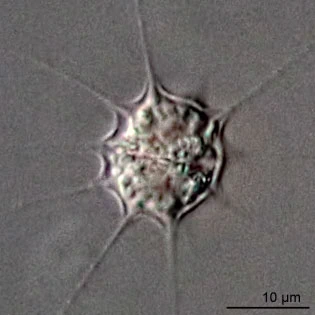 Hedriocystis pellucida