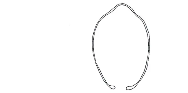 Hyalosphenia irregularis