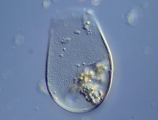 Hyalosphenia punctata