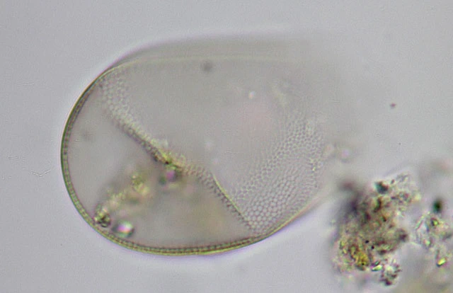 Hyalosphenia punctata