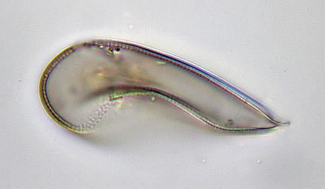 Hyalosphenia punctata