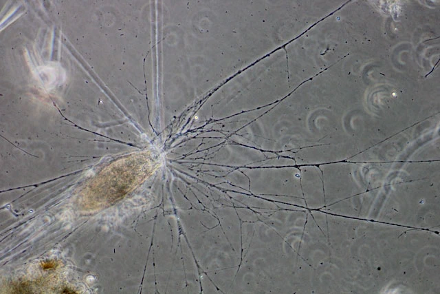 Lacogromia cassipara
