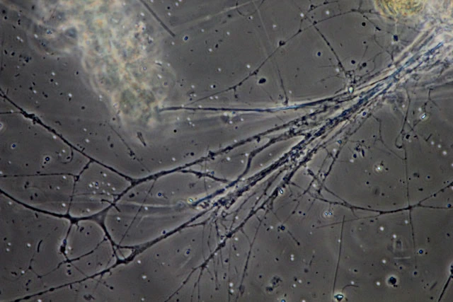 Lacogromia cassipara