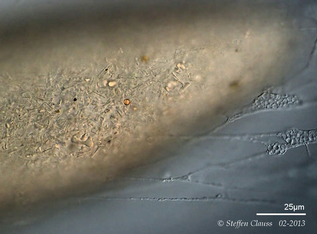 Lacogromia cassipara