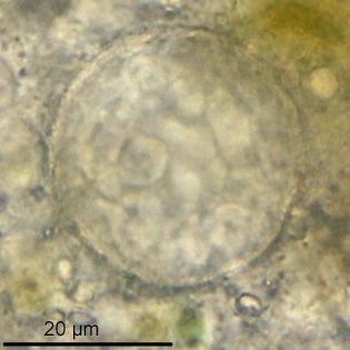 Lacogromia cassipara