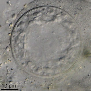 Lacogromia cassipara