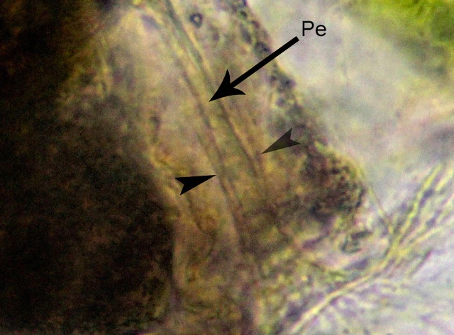 Lacogromia cassipara