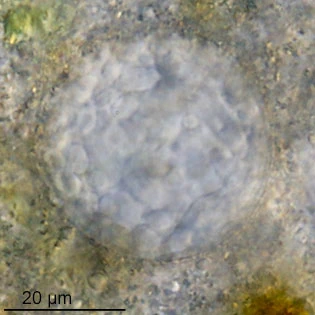 Lacogromia cassipara