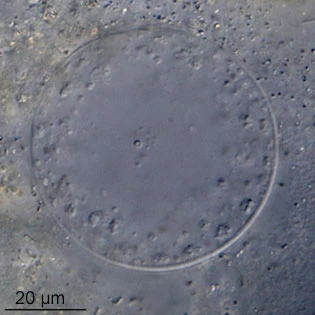 Lacogromia cassipara