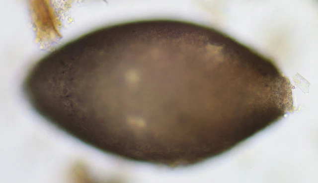 Lacogromia cassipara