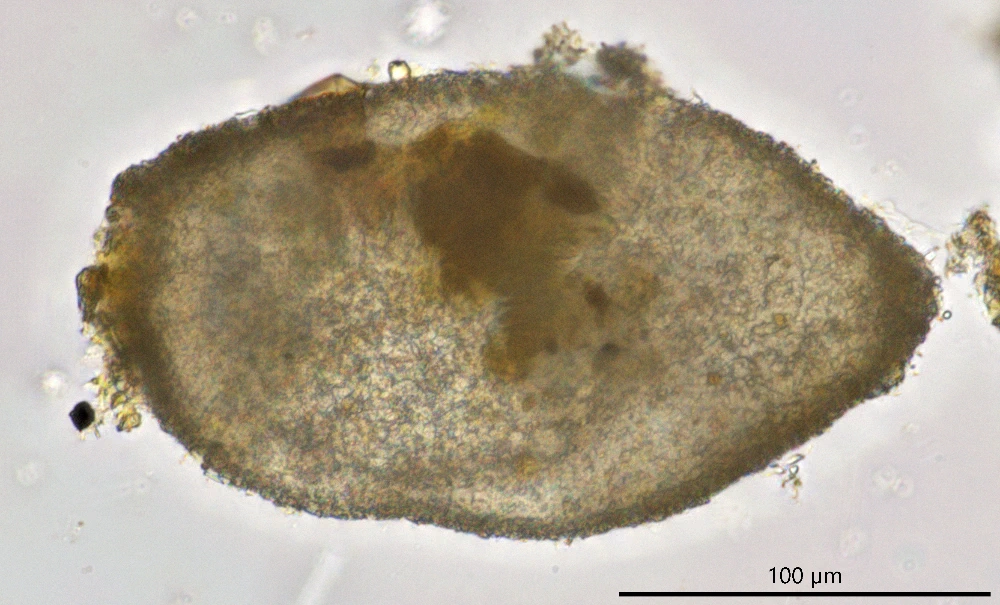 Lacogromia