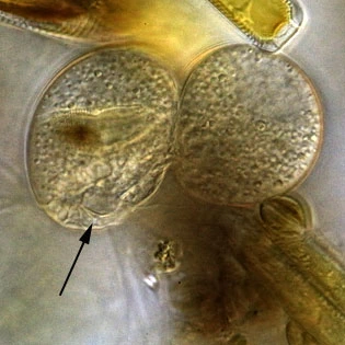 Lecythium granulatus