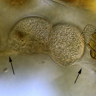 Lecythium granulatus