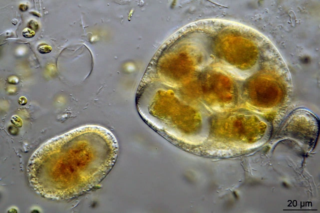 Leptophrys spec.