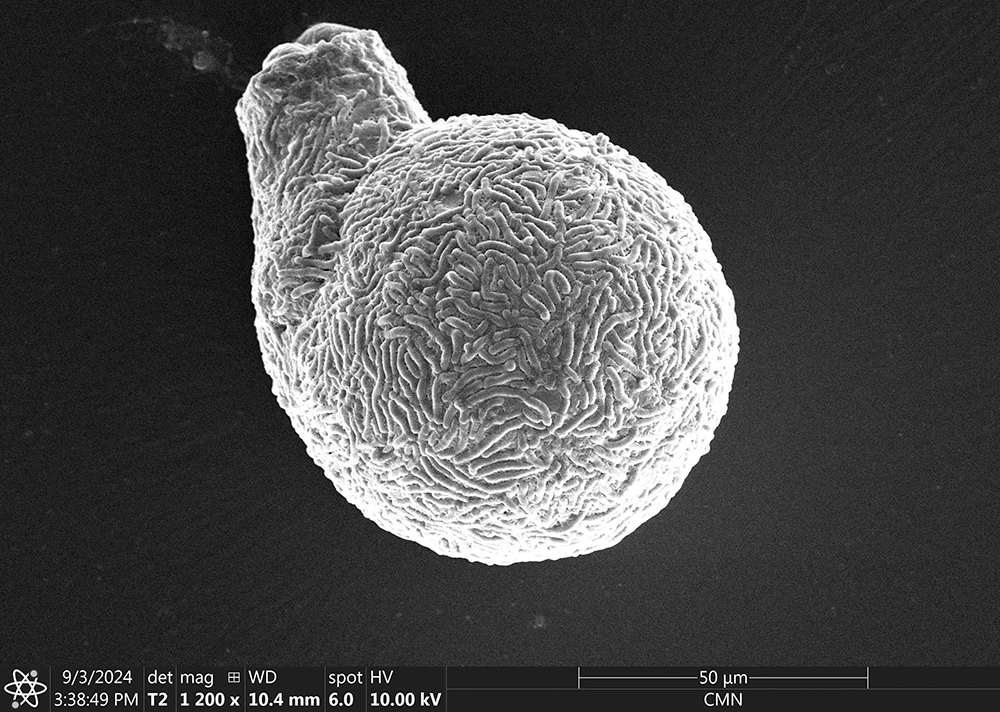 Lesquereusia spiralis