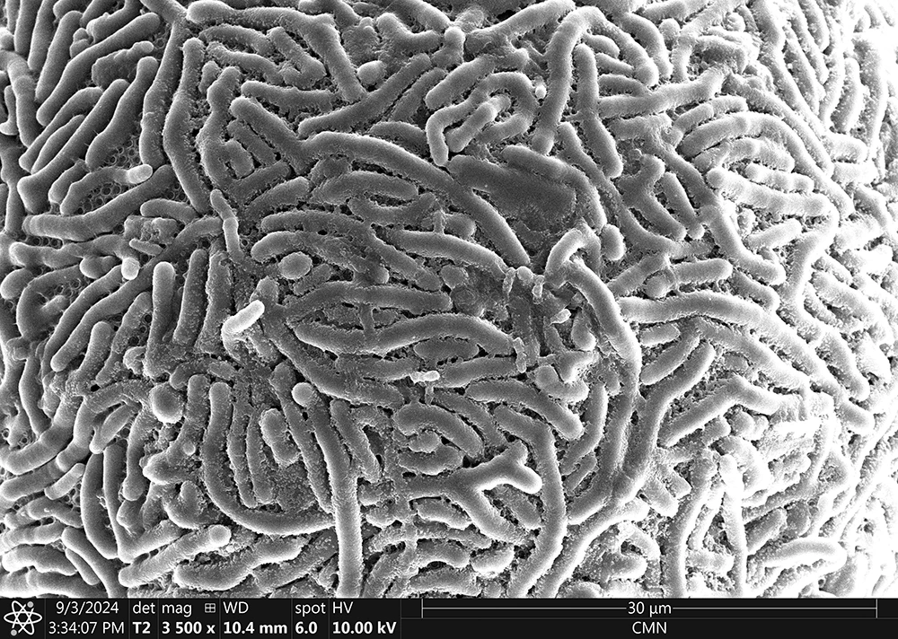 Lesquereusia spiralis