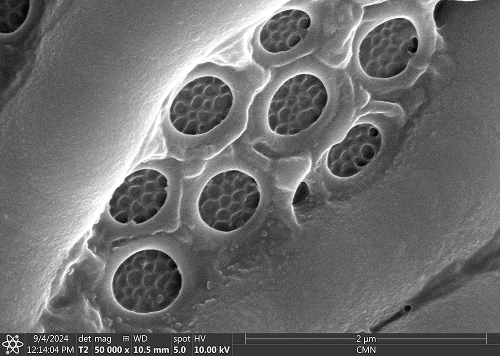 Lesquereusia spiralis