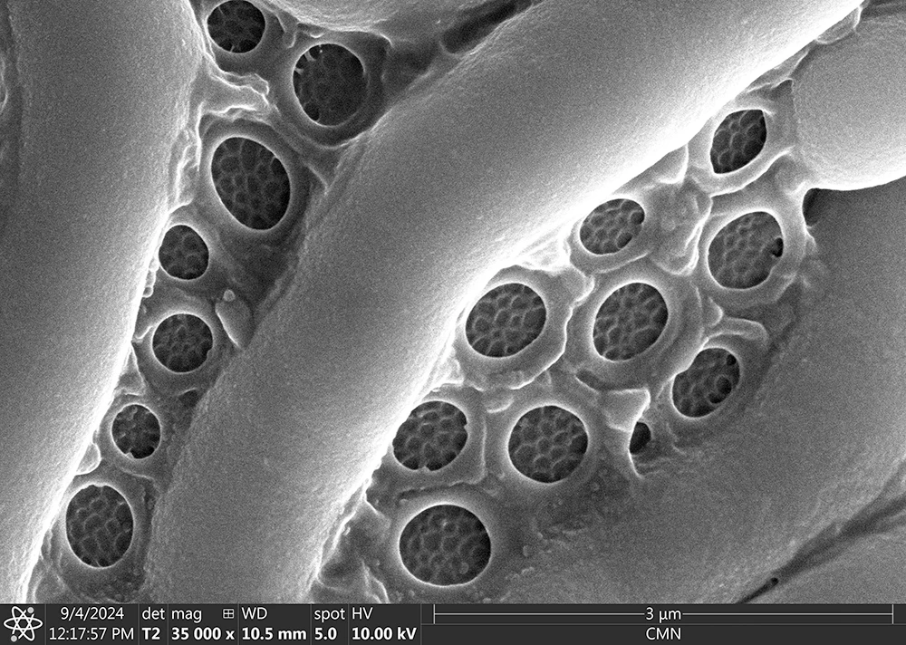 Lesquereusia spiralis