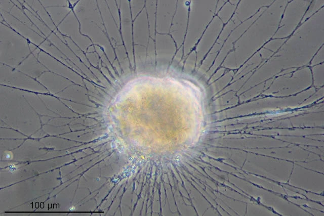 Lieberkuehnia wageneri