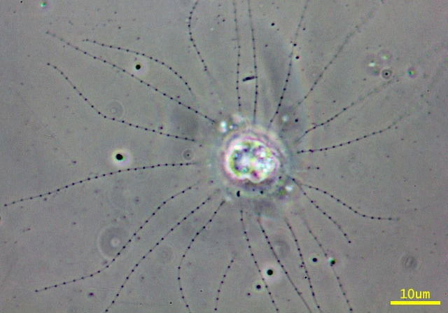 Clathrulina elegans