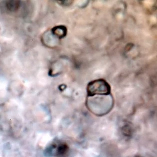 Mayorella augusta crystals