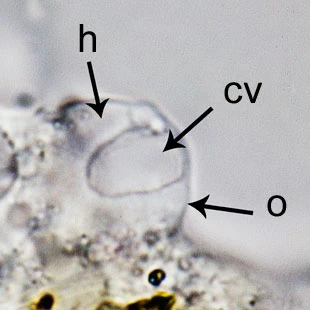 Mayorella contractile vacuole