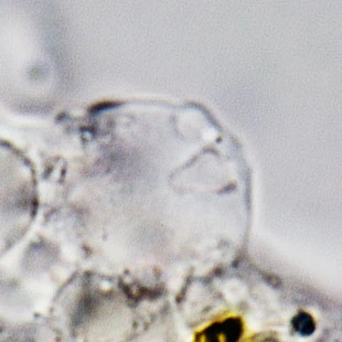 Mayorella contractile vacuole