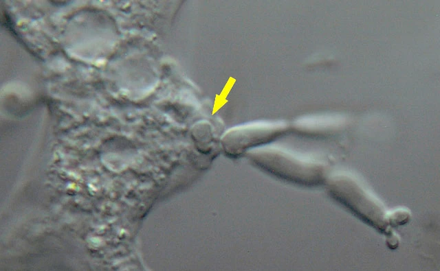 Mayorella with fungus